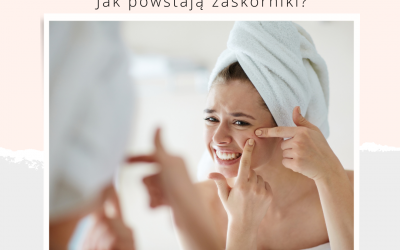 Jak powstają zaskórniki