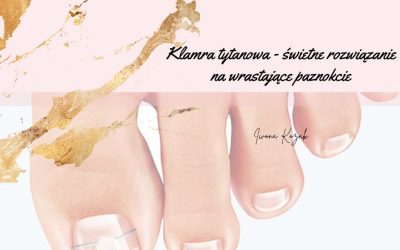 Klamra Tytanowa – świetne rozwiązanie na wrastające paznokcie